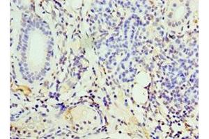 Immunohistochemistry of paraffin-embedded human pancreatic tissue using ABIN7156601 at dilution of 1:100 (IFNGR1 Antikörper  (AA 270-489))