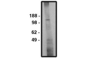 Image no. 1 for anti-Solute Carrier Family 9 (Sodium/hydrogen Exchanger), Member 6 (SLC9A6) antibody (ABIN793709) (SLC9A6 Antikörper)