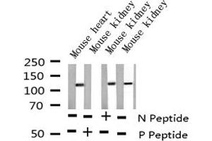 Western Blotting (WB) image for anti-Nuclear Factor of Activated T-Cells, Cytoplasmic, Calcineurin-Dependent 3 (NFATC3) (pSer165) antibody (ABIN6256165)