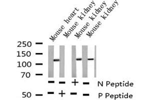Western blot analysis of Phospho-NFAT4 (Ser165) expression in various lysates (NFATC3 Antikörper  (pSer165))