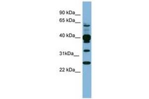 Image no. 1 for anti-Pleckstrin (PLEK) (N-Term) antibody (ABIN6741695) (Pleckstrin Antikörper  (N-Term))