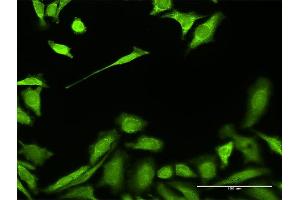 Immunofluorescence of purified MaxPab antibody to HADH on HeLa cell. (HADH Antikörper  (AA 1-314))