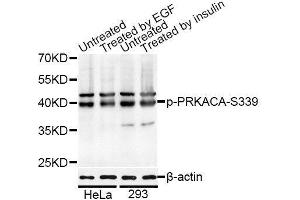 Western blot analysis of extracts of HeLa and 293 cells, using Phospho-PRKACA-S339 antibody (ABIN5995921) at 1/1000 dilution. (PRKACA Antikörper  (pSer339))