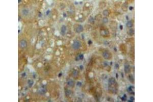 Used in DAB staining on fromalin fixed paraffin-embedded Liver tissue (ITGAL Antikörper  (AA 809-1066))