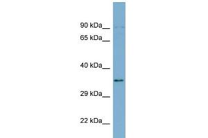 WB Suggested Anti-UBXN1 Antibody Titration: 0. (UBXN1 Antikörper  (Middle Region))