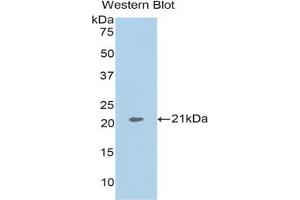 Western blot analysis of the recombinant protein. (ARPC4 Antikörper  (AA 3-163))