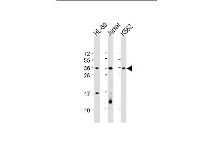 All lanes : Anti-RSPO1 Antibody (C-Term) at 1:2000 dilution Lane 1: HL-60 whole cell lysate Lane 2: Jurkat whole cell lysate Lane 3: K562 whole cell lysate Lysates/proteins at 20 μg per lane. (RSPO1 Antikörper  (AA 206-240))