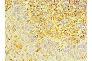 Immunohistochemistry of paraffin-embedded human tonsil tissue using ABIN7150706 at dilution of 1:100 (MAP2K3 Antikörper  (AA 1-170))