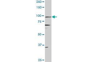 PGR monoclonal antibody (M08), clone 4E9. (Progesterone Receptor Antikörper  (AA 1-110))