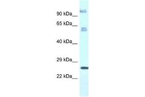 Western Blot showing TMEM222 antibody used at a concentration of 1. (TMEM222 Antikörper  (C-Term))