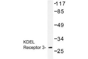 Image no. 1 for anti-KDEL (Lys-Asp-Glu-Leu) Endoplasmic Reticulum Protein Retention Receptor 3 (kDELR3) antibody (ABIN317836) (KDELR3 Antikörper)