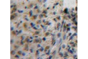 Used in DAB staining on fromalin fixed paraffin-embedded Ovary tissue (AFT1 Antikörper  (AA 3-213))