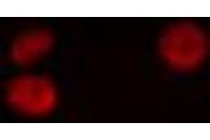 ABIN6274895 staining HeLa cells by IF/ICC. (Atrophin 1 Antikörper  (N-Term))