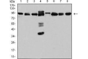 Western blot analysis using DDX1 mouse mAb against Hela (1), MCF-7 (2), A431 (3), PC-3 (4), NIH/3T3 (5), Jurkat (6), U251 (7), and HEK293 (8) cell lysate. (DDX1 Antikörper  (AA 642-740))