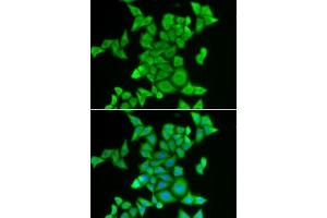 Immunofluorescence analysis of MCF7 cells using STRN3 antibody . (STRN3 Antikörper  (AA 200-460))