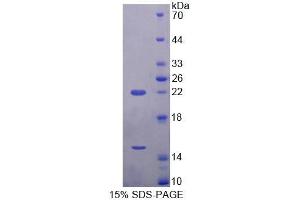 SDS-PAGE analysis of Mouse ECE2 Protein. (ECE2 Protein)