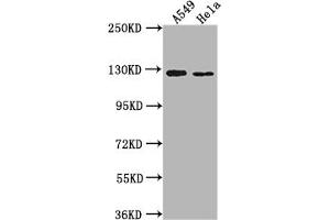 Western Blot Positive WB detected in: A549 whole cell lysate, Hela whole cell lysate All lanes: IGSF3 antibody at 1:2000 Secondary Goat polyclonal to rabbit IgG at 1/50000 dilution Predicted band size: 136, 138 kDa Observed band size: 125 kDa (IGSF3 Antikörper  (AA 111-399))