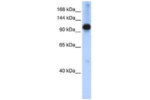 Western Blotting (WB) image for anti-SWI/SNF Related, Matrix Associated, Actin Dependent Regulator of Chromatin, Subfamily A-Like 1 (SMARCAL1) (N-Term) antibody (ABIN2775719)