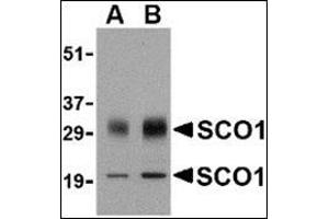Western blot analysis of SCO1 in human brain tissue lysate with this product at (A) 0. (SCO1 Antikörper  (Center))