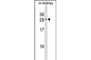 VPS25 Antibody (C-term) (ABIN1881995 and ABIN2838714) western blot analysis in kidney cell line lysates (35 μg/lane). (VPS25 Antikörper  (C-Term))