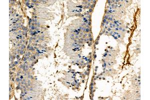 Phospho-PBK/TOPK (Ser32) Antibody at 1/100 staining Mouse testis tissue by IHC-P. (PBK Antikörper  (pSer32))