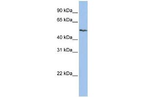 WB Suggested Anti-SLC16A6 Antibody Titration:  0. (SLC16A6 Antikörper  (Middle Region))
