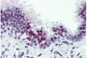 Human Lung (formalin-fixed, paraffin-embedded) stained with CASZ1 antibody ABIN364232 at 5 ug/ml followed by biotinylated goat anti-rabbit IgG secondary antibody ABIN481713, alkaline phosphatase-streptavidin and chromogen. (CASZ1 Antikörper  (N-Term))