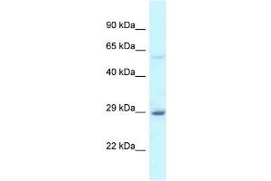 WB Suggested Anti-EIF6 Antibody Titration: 1. (EIF6 Antikörper  (C-Term))