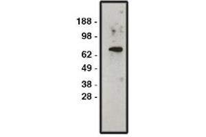Image no. 1 for anti-Solute Carrier Family 9, Subfamily A (NHE1, Cation Proton Antiporter 1), Member 1 (SLC9A1) antibody (ABIN4620363) (SLC9A1 Antikörper)