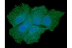 ICC/IF analysis of SOD1 in Hep3B cells line, stained with DAPI (Blue) for nucleus staining and monoclonal anti-human SOD1 antibody (1:100) with goat anti-mouse IgG-Alexa fluor 488 conjugate (Green).