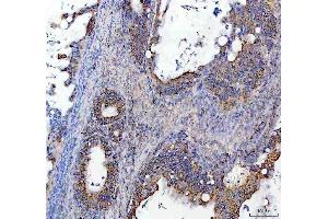 IHC analysis of SOCS5 using anti-SOCS5 antibody (ABIN7601562). (SOCS5 Antikörper  (AA 386-536))