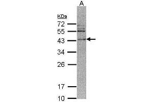 WB Image Sample (30 ug of whole cell lysate) A: 293T 12% SDS PAGE antibody diluted at 1:500 (CAMK1D Antikörper)