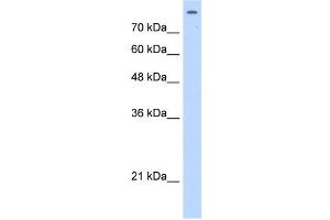 Matrin 3 antibody used at 2.
