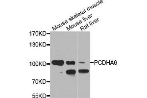 Western blot analysis of extracts of various cell lines, using PCDHA6 antibody. (PCDHA6 Antikörper)