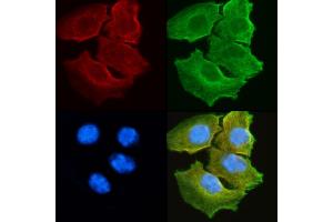 ABIN6263871 and ABIN6278612 staining Hela cells(30 min of UV treatment) by IF/ICC.