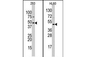 Western blot analysis of SUV39H2 polyclonal antibody  in 293 and HL-60 cell line lysates (35 ug/lane). (SUV39H2 Antikörper  (AA 308-337))