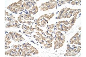 FARS2 antibody was used for immunohistochemistry at a concentration of 4-8 ug/ml to stain Skeletal muscle cells (arrows) in Human Muscle.