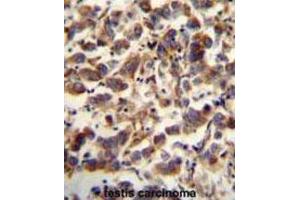 Immunohistochemistry (IHC) image for anti-Transcription Factor A, Mitochondrial (TFAM) antibody (ABIN5015230) (TFAM Antikörper)