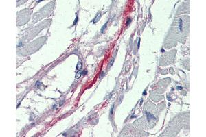 Anti-DDAH2 antibody IHC of human heart. (DDAH2 Antikörper  (N-Term))