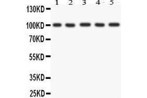 Anti- FGFR4 antibody, Western blotting All lanes: Anti FGFR4  at 0. (FGFR4 Antikörper  (AA 22-206))
