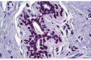 Human Breast: Formalin-Fixed, Paraffin-Embedded (FFPE) (STAT1 Antikörper  (AA 694-743))