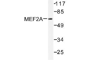 Image no. 1 for anti-Myocyte Enhancer Factor 2A (MEF2A) antibody (ABIN265517) (MEF2A Antikörper)