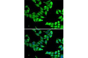 Immunofluorescence analysis of U2OS cells using OGFR Rabbit pAb (ABIN6128395, ABIN6145006, ABIN6145007 and ABIN6222871) at dilution of 1:50 (40x lens).