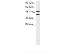 Image no. 1 for anti-Zinc Finger Protein 839 (ZNF839) (AA 530-579) antibody (ABIN202500) (ZNF839 Antikörper  (AA 530-579))