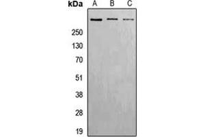Western blot analysis of ATM (pS1981) expression in Hela (A), Raw264. (ATM Antikörper  (pSer1981))
