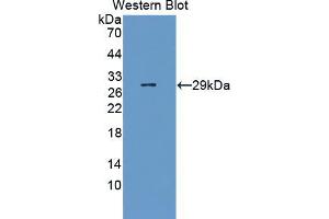 Western blot analysis of the recombinant protein. (URGCP Antikörper  (AA 689-924))