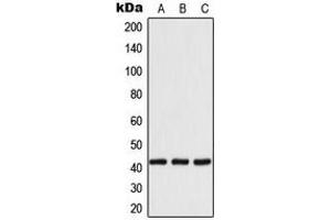 Western blot analysis of 14-3-3 eta expression in MCF7 (A), SP2/0 (B), H9C2 (C) whole cell lysates. (14-3-3 eta Antikörper  (Center))
