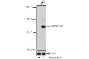 Western blot analysis of extracts of 293T cells, using Phospho-ULK1-S555 antibody (ABIN6135333, ABIN6136282, ABIN6136283 and ABIN6225654) at 1:1000 dilution. (ULK1 Antikörper  (pSer555))