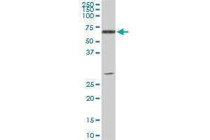 ATP6AP1 monoclonal antibody (M01), clone 3A2. (ATP6AP1 Antikörper  (AA 51-150))