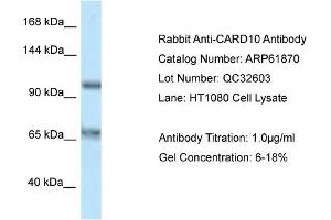Western Blotting (WB) image for anti-Caspase Recruitment Domain Family, Member 10 (CARD10) (C-Term) antibody (ABIN970291) (CARD10 Antikörper  (C-Term))